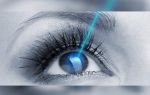 Тонкая роговица глаза: лечение и коррекция патологии