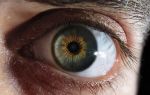 Начальная стадия катаракты глаз: от первых признаков до лечения