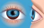 Гифема: что нужно знать о кровоизлиянии в глаз
