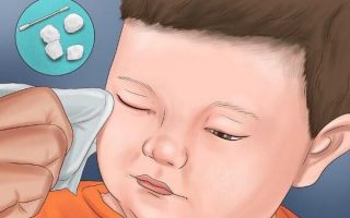 Чем и как правильно промывать глаза при конъюнктивите у ребенка?