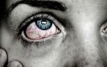 Глаз гноится и красный — о какой это говорит болезни и как ее лечить?