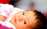 Почему желтые белки глаз у новорожденного – когда пройдет, нужно ли лечить