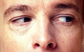 Что такое нистагм глаз у взрослых и детей: симптомы и лечение