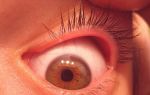 Что делать если болит глаз под верхним веком – причины и характер боли