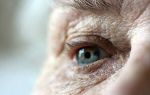 Описание вторичной глаукомы и лечение, дающее возможность восстановить зрение