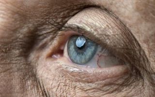 Что такое макулодистрофия сетчатки глаза: признаки и эффективное лечение