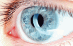 Аметропия глаза – нарушение фокусировки света