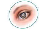 Причины помутнения хрусталика глаза — методы лечения