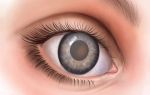 Помутнение роговицы глаза (лейкома, бельмо): не затягивайте визит к офтальмологу!