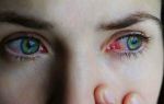 Самые частые причины красных глаз: диагностика и результативное лечение