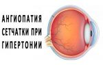 Причины развития гипертонической ангиопатии сетчатки — есть ли шанс вернуть зрение