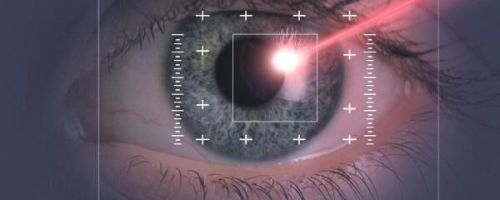 Лечение близорукости при помощи лазера: навсегда ли коррекция избавит от очков