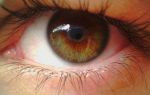 Дистрофия сетчатки глаза: патология зрения, которая приводит к серьезным последствиям