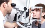 Для чего проводят пахиметрию глаз — показатели и их расшифровка, норма