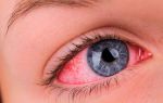 Можно ли спать в контактных линзах для глаз – что может случиться