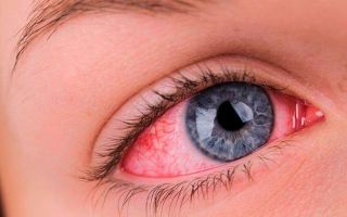 Можно ли спать в контактных линзах для глаз – что может случиться