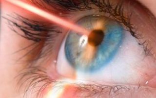 Коррекция зрения — методы исправления дефектов