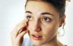 Почему при надавливании болит глаз: неожиданные причины и лечение