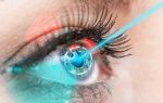 Особенности лечения катаракты лазером: подготовка, ход операции и восстановление, стоимость