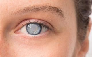 Что такое глаукома глаз, причины, своевременная диагностика и лечение
