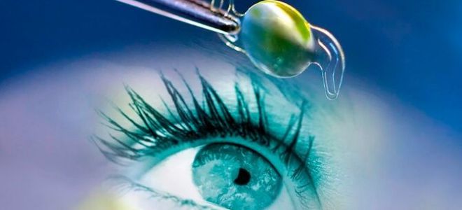 Что из себя представляет искусственный хрусталик глаза — ТОП-3 производителей