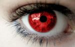 Бывает ли у человека красный цвет глаз: мистика или заболевание?