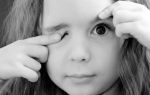 Почему дергается глаз у ребенка, что с этим делать и как помочь малышу